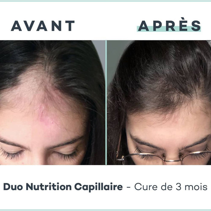 Haarpflege-Vitamin-Set mit Keratin, Biotin und Arganöl - D-Lab